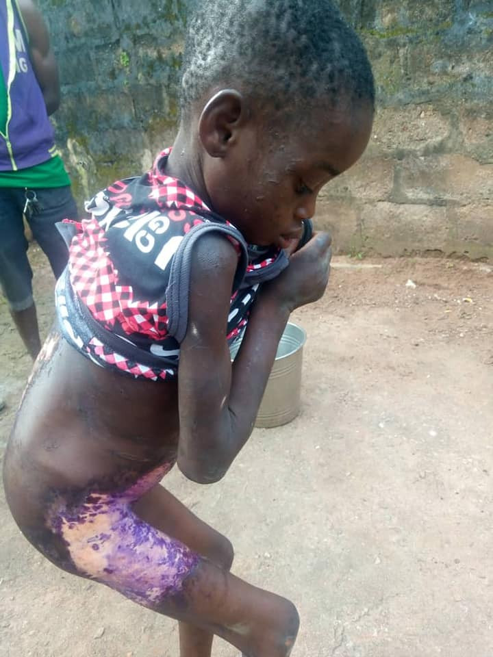 8-year-old househelp boiled with hot water by woman causes stir on-line