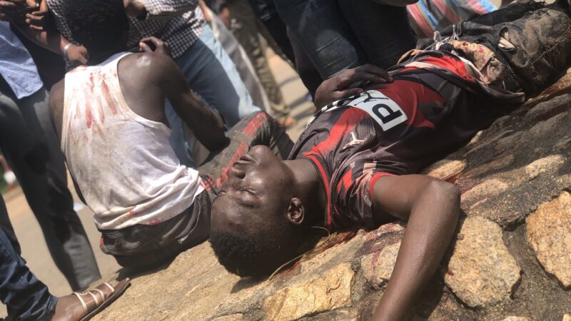 Photos of wounded Nigerians, vandalised cars in #EndSars, #ProSARS clash in Abuja