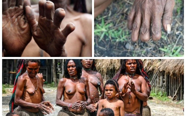 Bizarre! Revealed country where people cut off fingers to pay dowry
