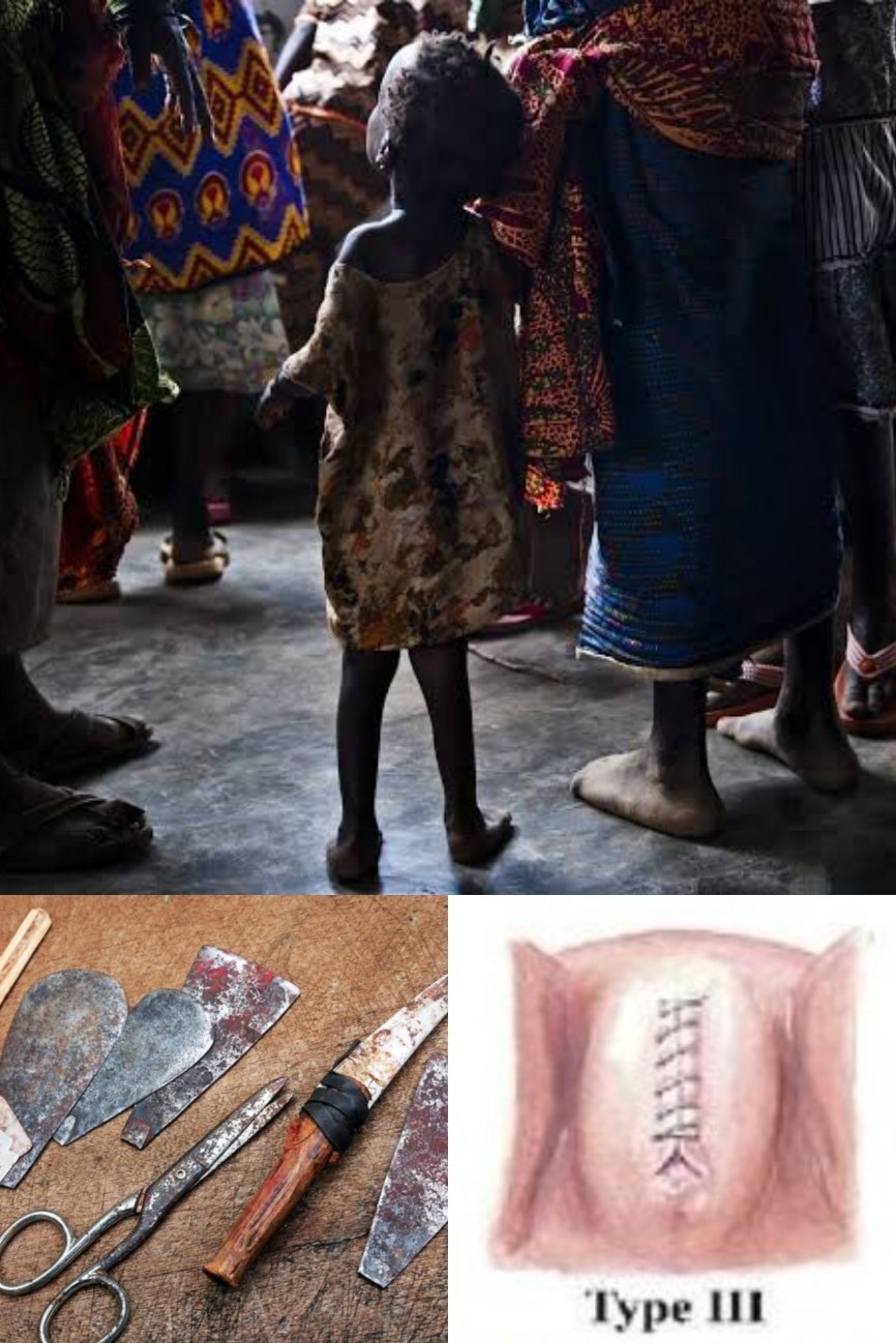 FGM: Police arrests five female circumcisers